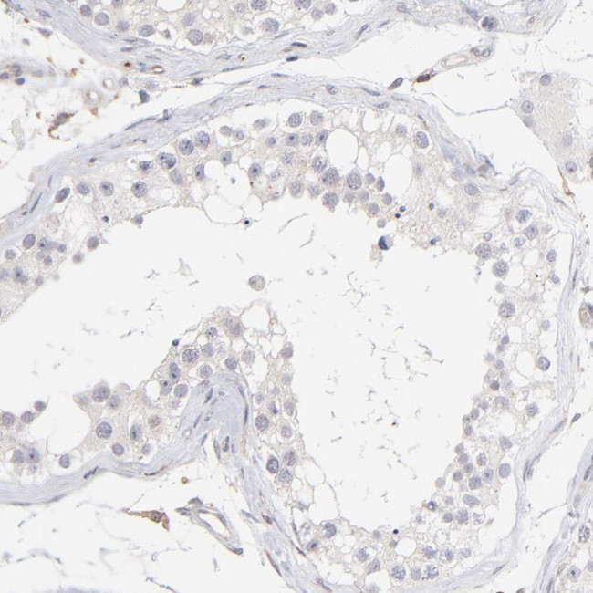 WIPF1 Antibody in Immunohistochemistry (Paraffin) (IHC (P))