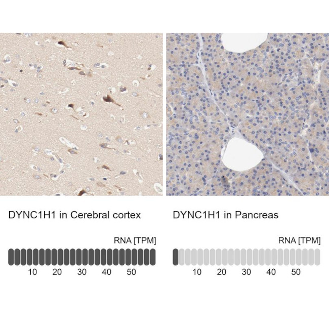 DYNC1H1 Antibody in Immunohistochemistry (IHC)