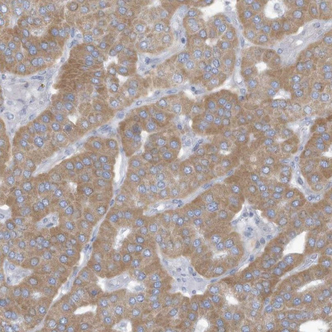 TRMT2B Antibody in Immunohistochemistry (IHC)
