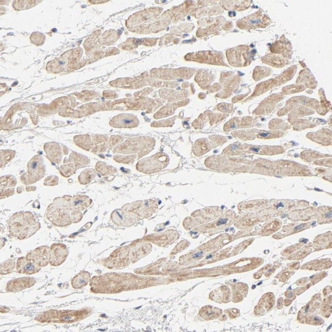 Tara Antibody in Immunohistochemistry (Paraffin) (IHC (P))
