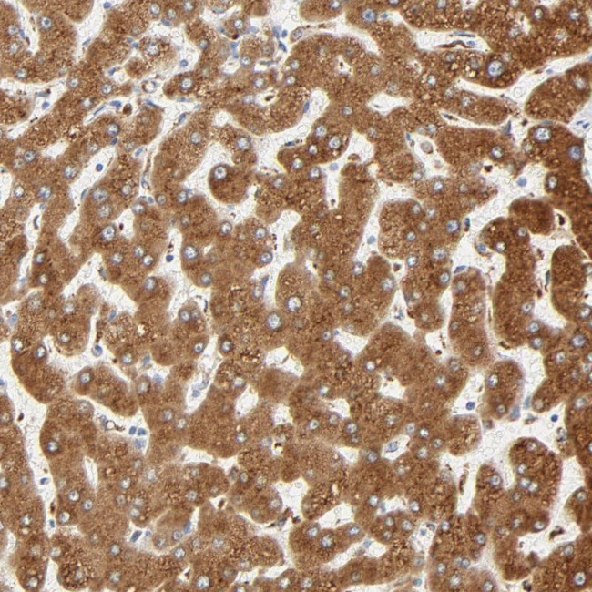 MAGEB17 Antibody in Immunohistochemistry (Paraffin) (IHC (P))