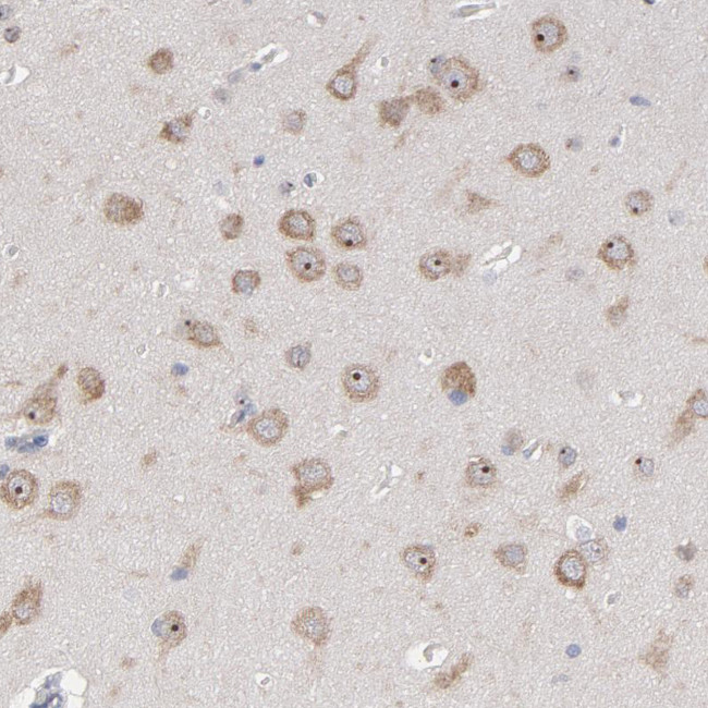 PNMA1 Antibody in Immunohistochemistry (Paraffin) (IHC (P))