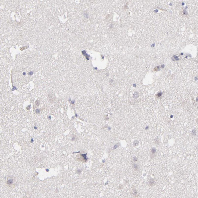Factor XIII B Antibody in Immunohistochemistry (IHC)