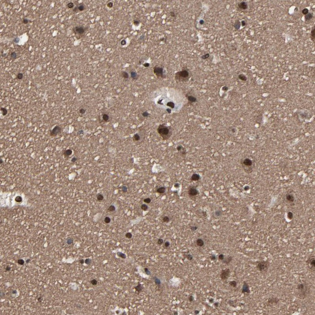 PDZD4 Antibody in Immunohistochemistry (Paraffin) (IHC (P))