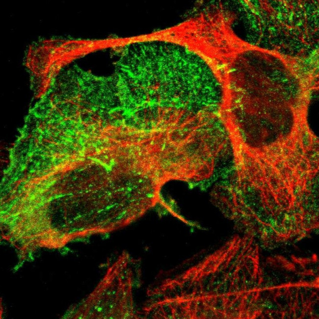 PDLIM2 Antibody in Immunocytochemistry (ICC/IF)