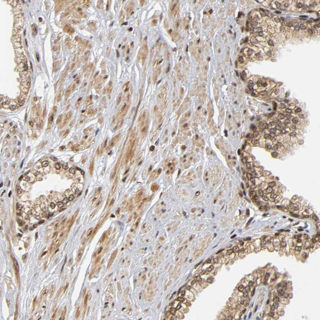 RNF122 Antibody in Immunohistochemistry (Paraffin) (IHC (P))