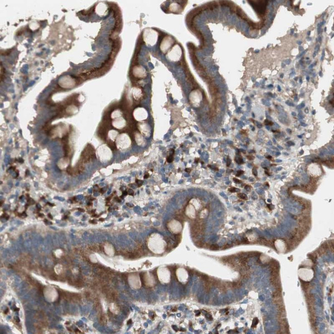 RARRES1 Antibody in Immunohistochemistry (Paraffin) (IHC (P))