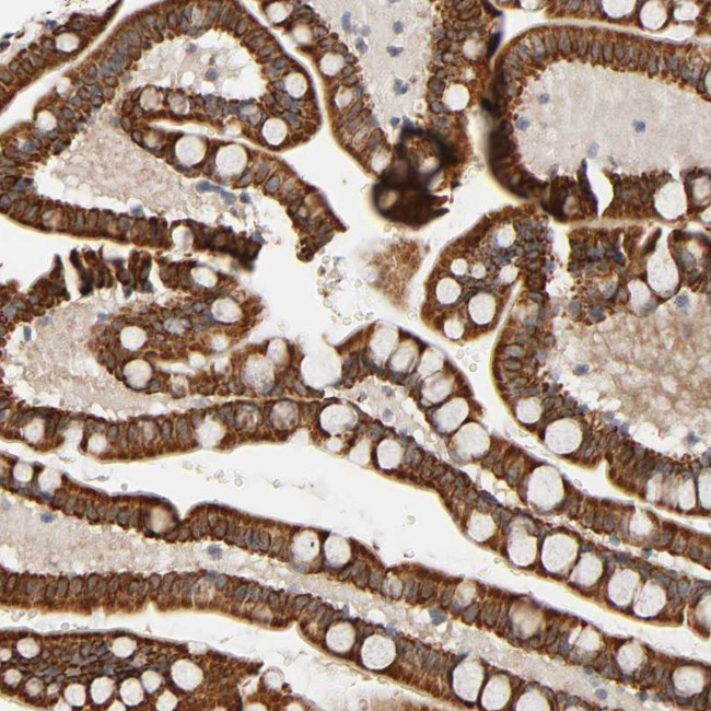 REEP5 Antibody in Immunohistochemistry (Paraffin) (IHC (P))