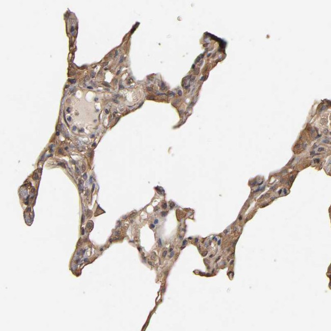 VSIG4 Antibody in Immunohistochemistry (IHC)