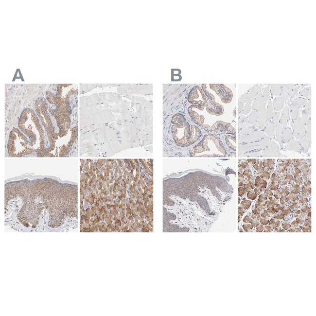 PPFIBP2 Antibody in Immunohistochemistry (Paraffin) (IHC (P))