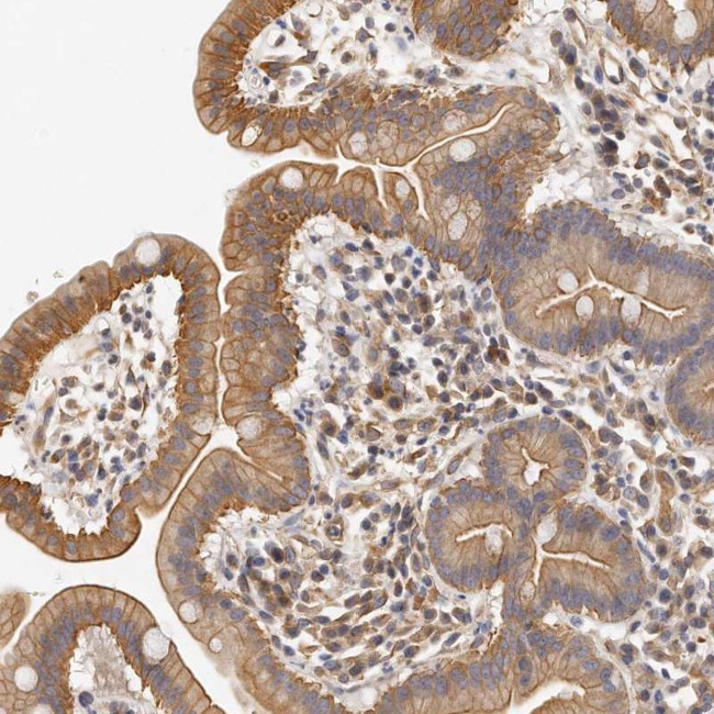 CHST7 Antibody in Immunohistochemistry (Paraffin) (IHC (P))