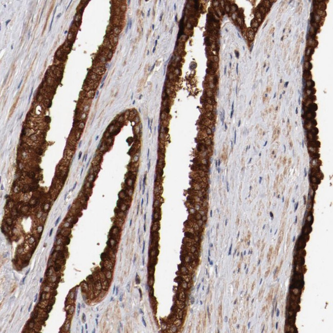 GUF1 Antibody in Immunohistochemistry (Paraffin) (IHC (P))