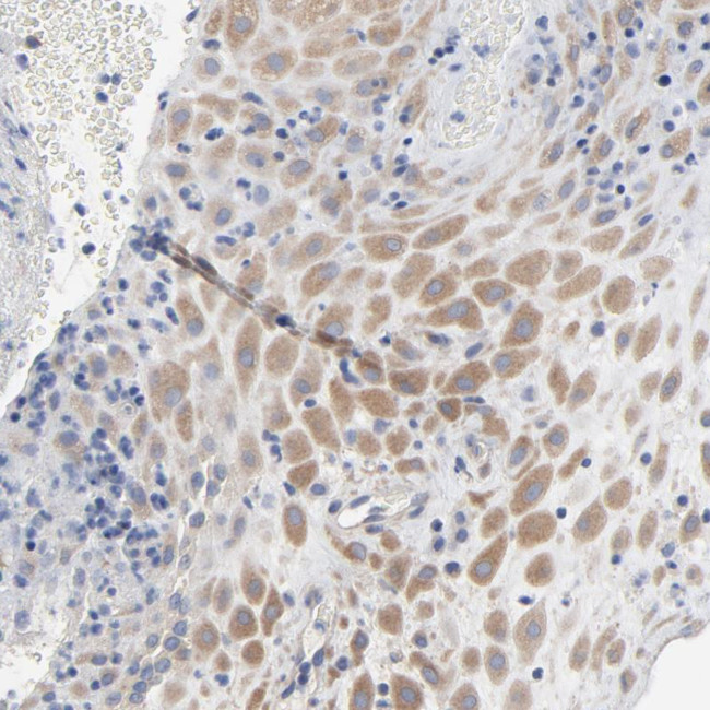 DYNLT3 Antibody in Immunohistochemistry (Paraffin) (IHC (P))