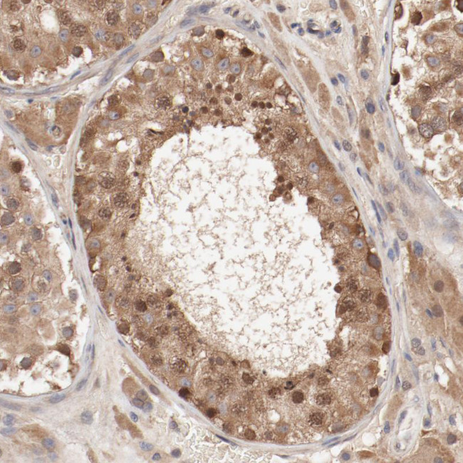 PITPNM2 Antibody in Immunohistochemistry (Paraffin) (IHC (P))