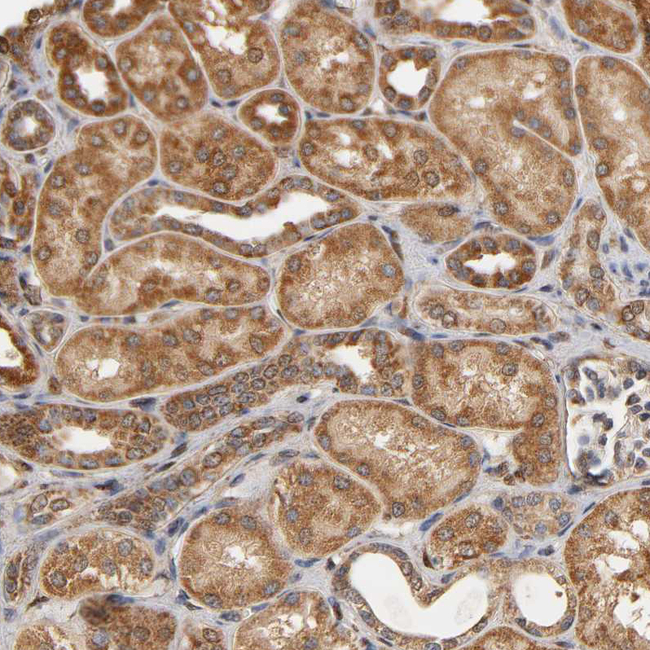 PKN1 Antibody in Immunohistochemistry (Paraffin) (IHC (P))