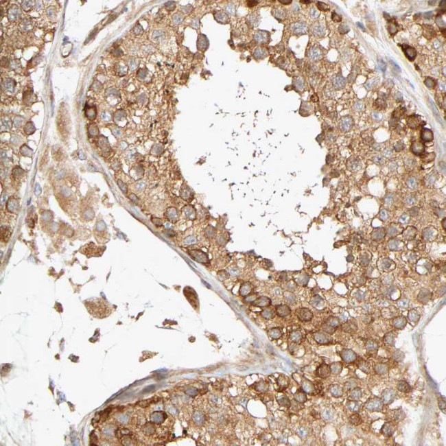 SGSM1 Antibody in Immunohistochemistry (IHC)
