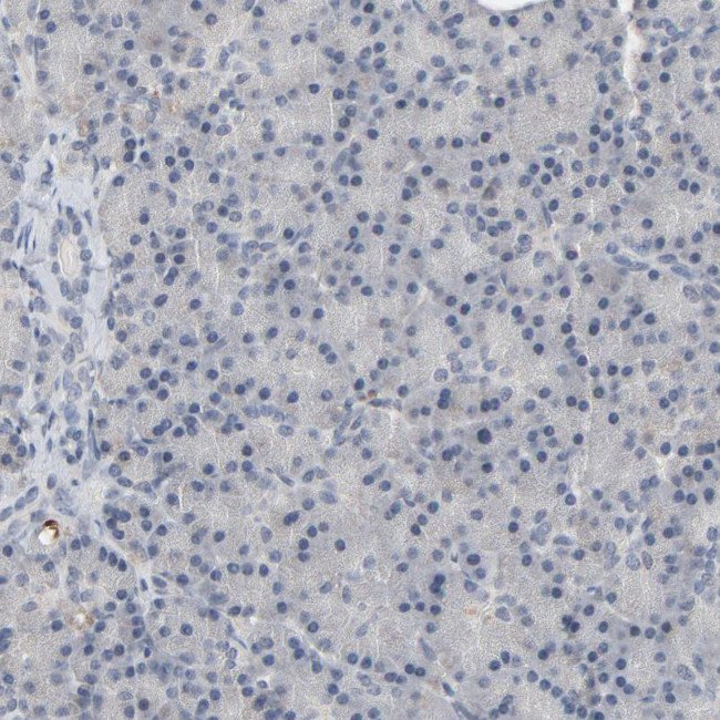MT3 Antibody in Immunohistochemistry (Paraffin) (IHC (P))