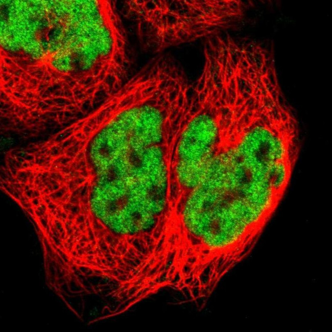 ZNF384 Antibody in Immunocytochemistry (ICC/IF)
