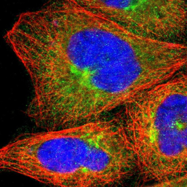 Njmu-R1 Antibody in Immunocytochemistry (ICC/IF)
