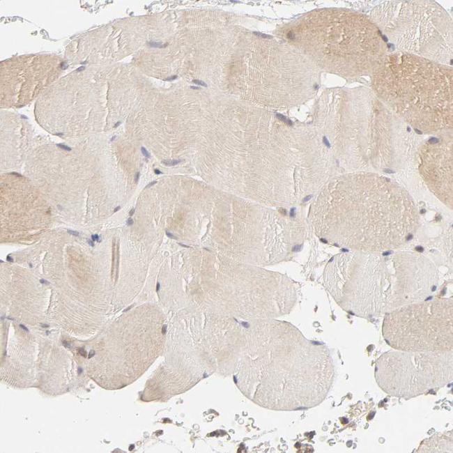 AP1G2 Antibody in Immunohistochemistry (Paraffin) (IHC (P))