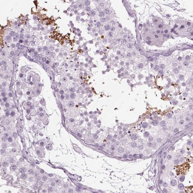 TPPP2 Antibody in Immunohistochemistry (IHC)
