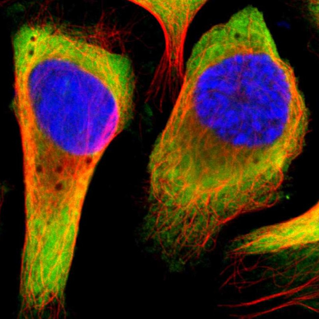 RPL14 Antibody in Immunocytochemistry (ICC/IF)