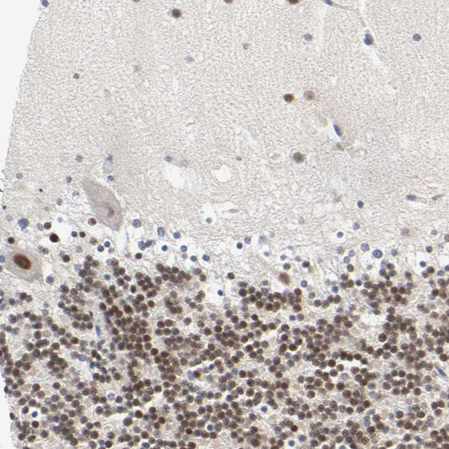 SALL2 Antibody in Immunohistochemistry (Paraffin) (IHC (P))
