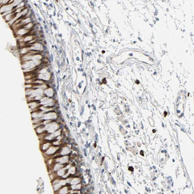LIMCH1 Antibody in Immunohistochemistry (Paraffin) (IHC (P))