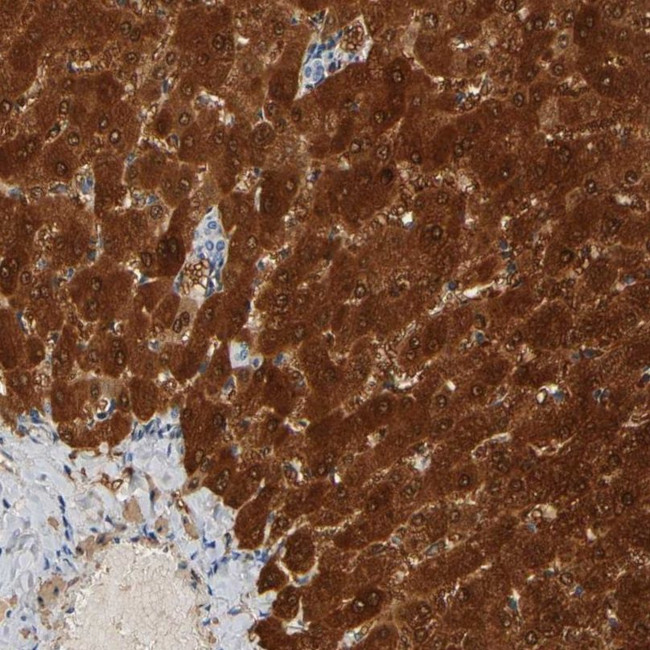 GSTA1 Antibody in Immunohistochemistry (IHC)