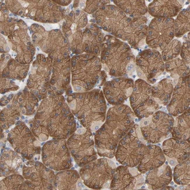 TAPP2 Antibody in Immunohistochemistry (IHC)