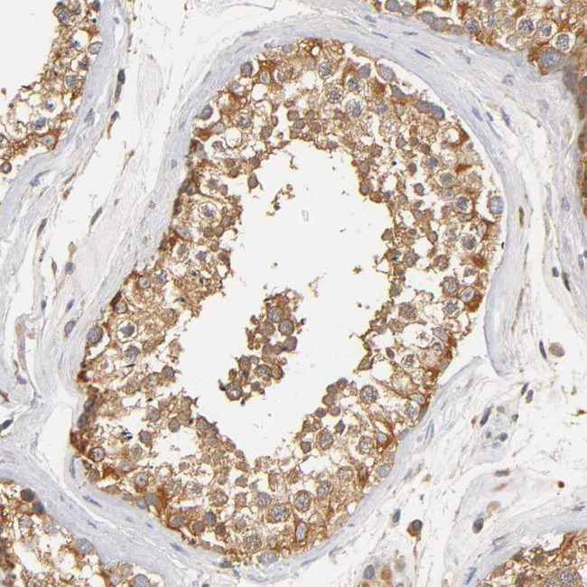 SCAP Antibody in Immunohistochemistry (Paraffin) (IHC (P))