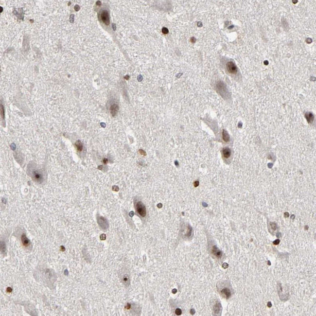 CPN2 Antibody in Immunohistochemistry (Paraffin) (IHC (P))