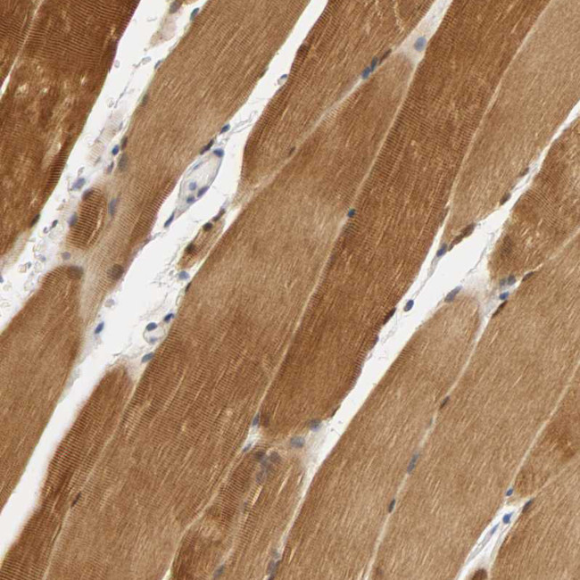 PDLIM3 Antibody in Immunohistochemistry (Paraffin) (IHC (P))