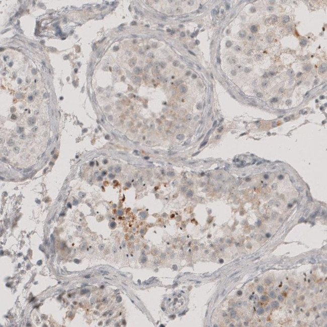 CT83 Antibody in Immunohistochemistry (IHC)