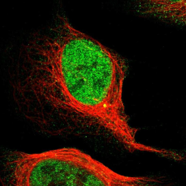 MCM3 Antibody in Immunocytochemistry (ICC/IF)