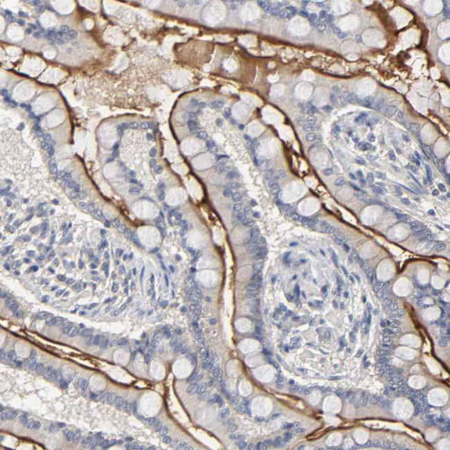 SLC10A2 Antibody in Immunohistochemistry (Paraffin) (IHC (P))