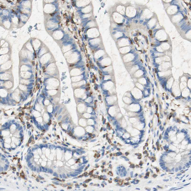 p41-ARCb Antibody in Immunohistochemistry (Paraffin) (IHC (P))