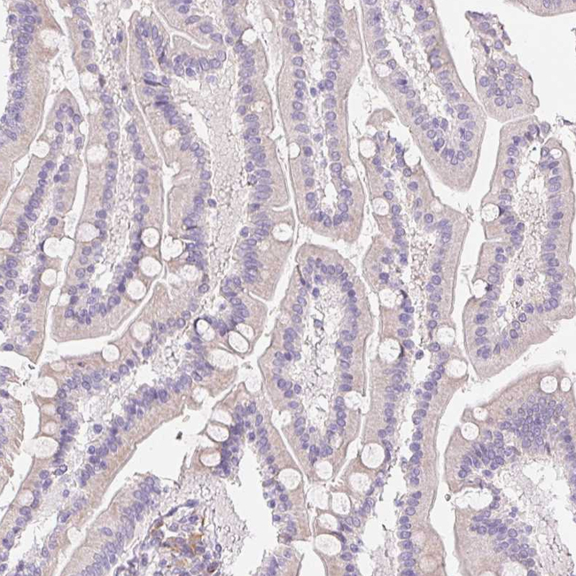 HRC Antibody in Immunohistochemistry (Paraffin) (IHC (P))
