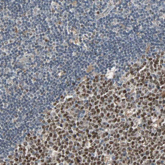 SCN7A Antibody in Immunohistochemistry (Paraffin) (IHC (P))