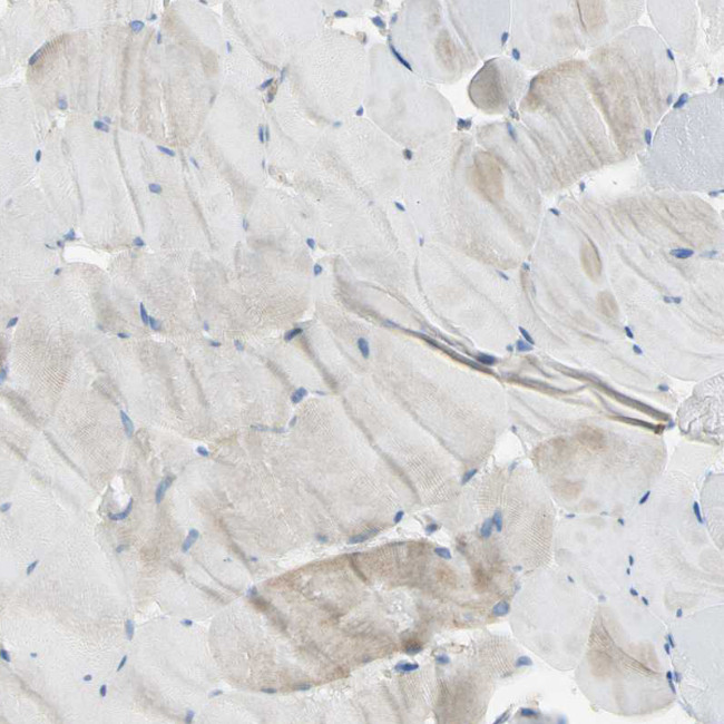 Filamin B Antibody in Immunohistochemistry (Paraffin) (IHC (P))