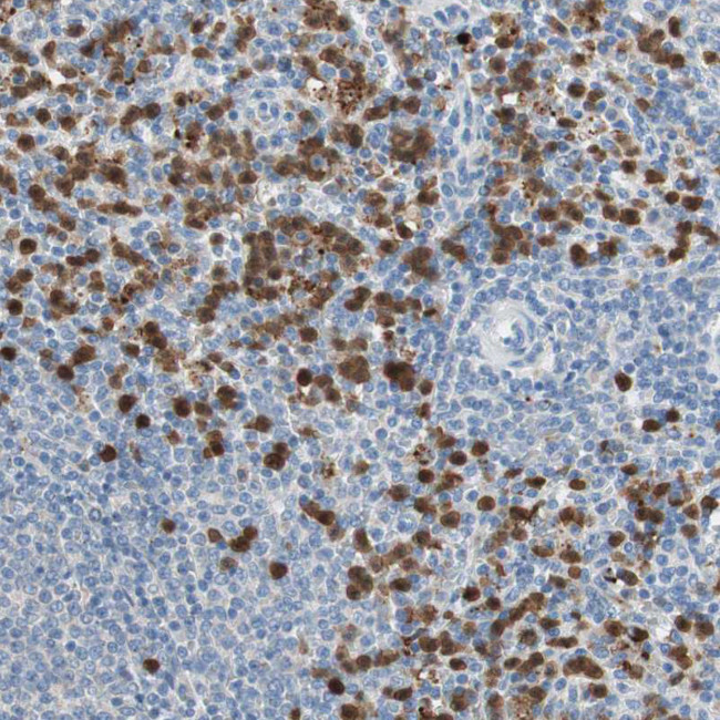 CLEC4D Antibody in Immunohistochemistry (Paraffin) (IHC (P))