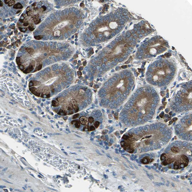DIAPH1 Antibody in Immunohistochemistry (Paraffin) (IHC (P))