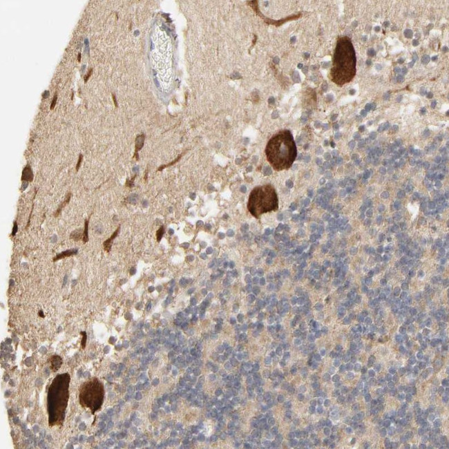 CLEC4E Antibody in Immunohistochemistry (Paraffin) (IHC (P))