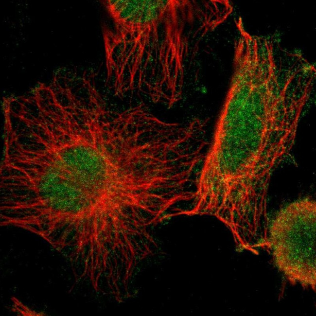 KIAA1217 Antibody in Immunocytochemistry (ICC/IF)
