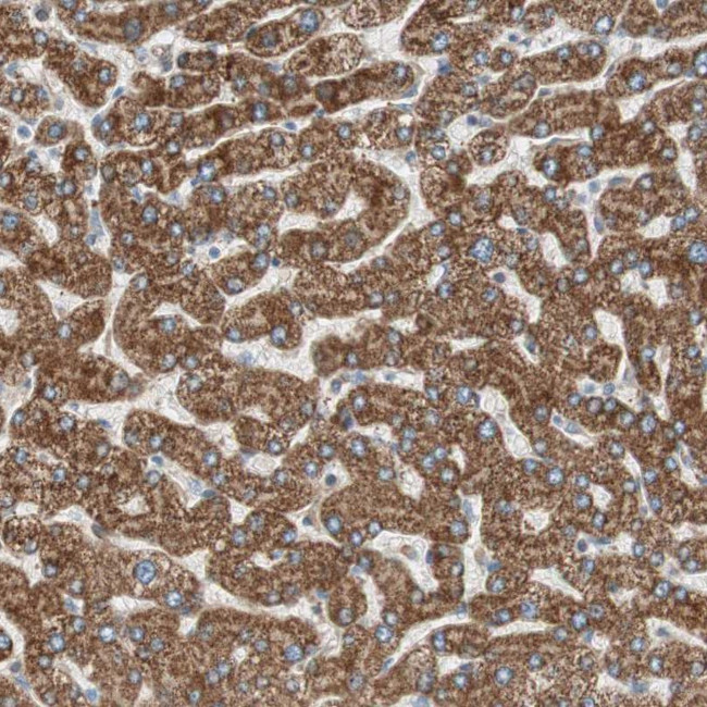 CC2D1A Antibody in Immunohistochemistry (Paraffin) (IHC (P))