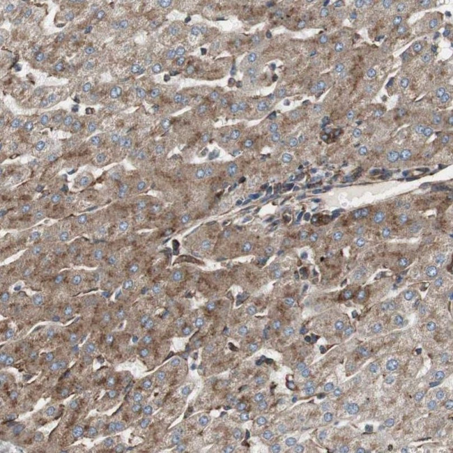 H6PD Antibody in Immunohistochemistry (IHC)