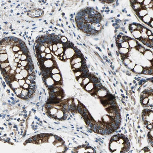 CHI3L2 Antibody in Immunohistochemistry (Paraffin) (IHC (P))