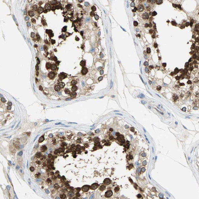 TULP4 Antibody in Immunohistochemistry (Paraffin) (IHC (P))