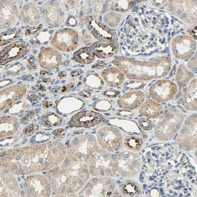 ASAH1 Antibody in Immunohistochemistry (IHC)