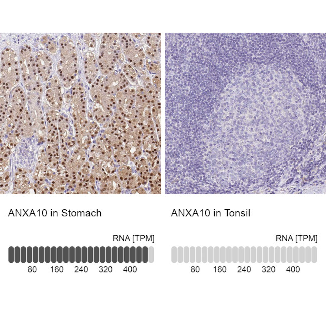 Annexin A10 Antibody in Immunohistochemistry (IHC)